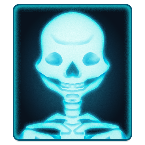 X-Ray