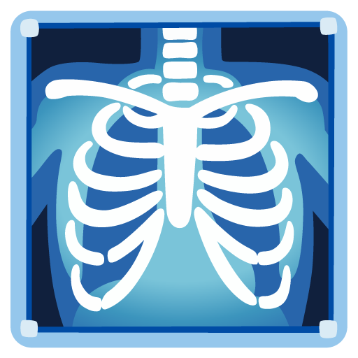 X-ray untuk Google 17.0