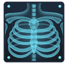 Рентген для Huawei HarmonyOS 4.0