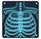 X-ray untuk Huawei HarmonyOS 5.0