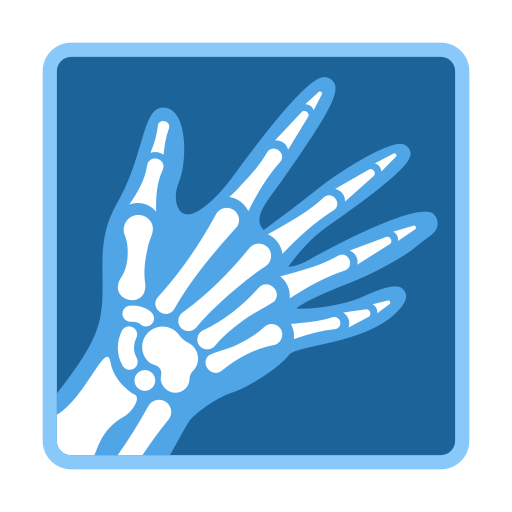 X-ray untuk Twitter (X) January 2025 Update